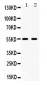 Anti-5HT2B Receptor Picoband Antibody