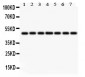 Anti-IDH1 Picoband Antibody