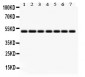 Anti-IDH2 Picoband Antibody
