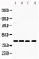 Anti-MICA Picoband Antibody