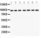 Anti-p95 NBS1 Picoband Antibody