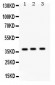 Anti-SP-D Antibody