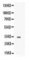 Anti-IL-8 Picoband Antibody