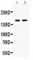 Anti-HDAC6 Picoband Antibody