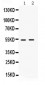 Anti-HSF4 Picoband Antibody