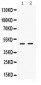 Anti-ING1 Picoband Antibody