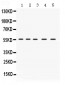 Anti-IRF5 Picoband Antibody