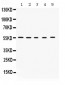 Anti-KCNA3 Picoband Antibody