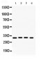 Anti-KChIP2 Picoband Antibody