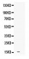 Anti-Leptin Picoband Antibody