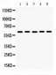 Anti-MAOA Picoband Antibody