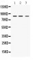 Anti-MEFV Picoband Antibody