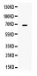 Anti-MMP-9 Antibody