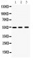 Anti-MMP10 Picoband Antibody