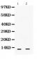 Anti-S100 Alpha 6 Picoband Antibody