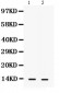 Anti-S100A9 Picoband Antibody