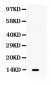 Anti-XCL1/Lymphotactin Antibody