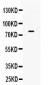 Anti-GRK3 Picoband Antibody