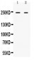 Anti-ARID1A Picoband Antibody