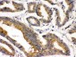 Anti-BMP-2 Antibody