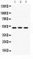 Anti-BMP-5 Antibody