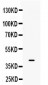 Anti-BMP6 Picoband Antibody