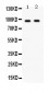 Anti-CD22 Picoband Antibody