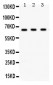 Anti-Chk2 Picoband Antibody