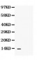 Anti-CXCL13/BLC Antibody