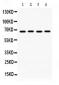 Anti-Pea3 Picoband Antibody