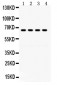 Anti-GRK6 Picoband Antibody