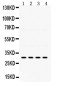 Anti-IGFBP-3 Antibody