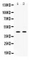 Anti-Cytokeratin 19 Picoband Antibody