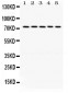 Anti-LIMK1 Picoband Antibody