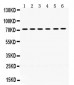 Anti-LIM Kinase 2 Picoband Antibody