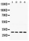 Anti-LOX Picoband Antibody