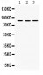 Anti-MLH1 Picoband Antibody