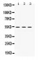 Anti-MMP-1 Antibody