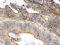 Anti-OSM/Oncostatin M Antibody