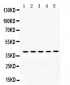 Anti-OSM/Oncostatin M Antibody