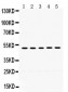 Anti-SDC1/Syndecan-1 Antibody