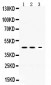 Anti-Neuroserpin Picoband Antibody