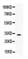 Anti-TREX1 Picoband Antibody