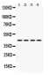 Anti-Actin Picoband Antibody