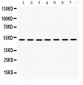 Anti-ADRA1A Picoband Antibody