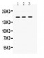 Anti-PDGFRA Picoband Antibody