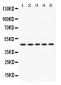Anti-PGK1 Picoband Antibody