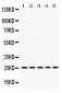 Anti-PGRMC1 Picoband Antibody