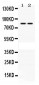 Anti-PLA2G4A Picoband Antibody