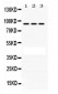 Anti-PRLR Picoband Antibody